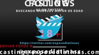 Exposedlatinas - Hispanic Eighteen Gets Cured With A New Method By Doctor - Ann Riding