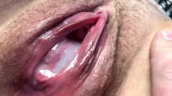 Cum Flows From A Meaty, Swollen And Fucked Up Pussy. Close-Up